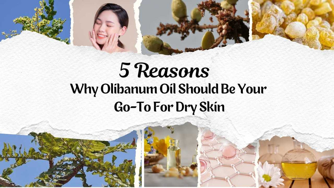 5 Reasons Why Olibanum Oil Should Be Your Go-To For Dry Skin